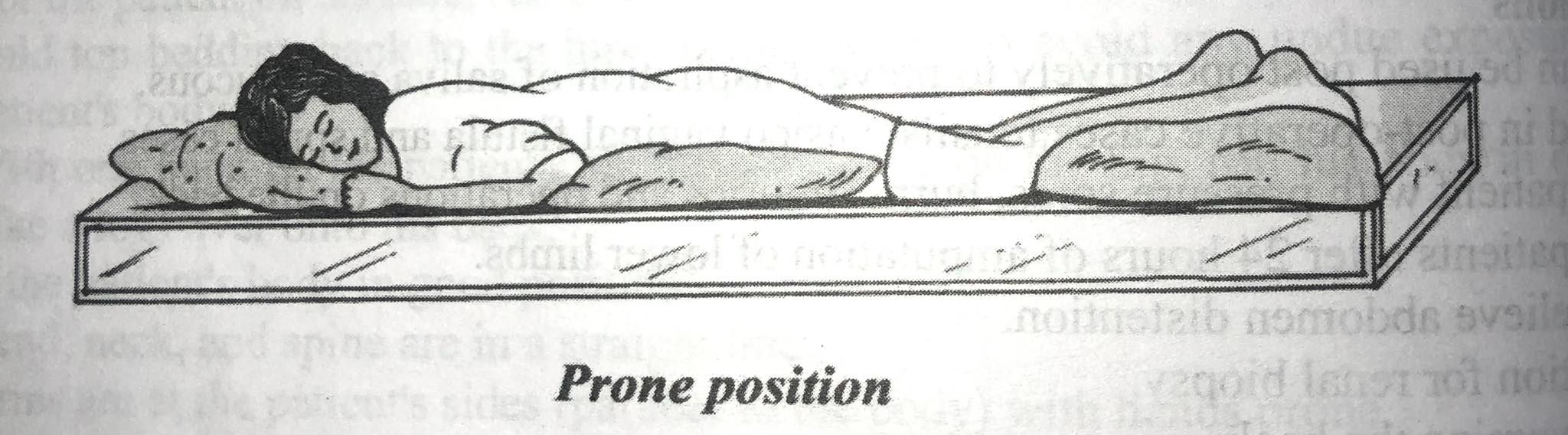Lateral-side Laying Position | Notes, Videos, QA and Tests | PCL ...